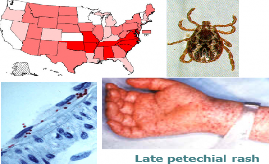 Rickettsial Infections - Flashcards