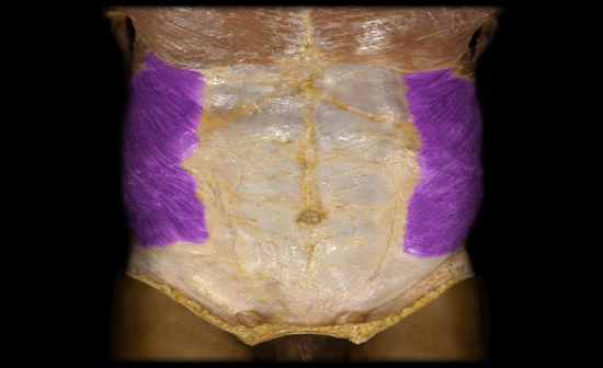 Muscles of the Abdominal Wall - Flashcards