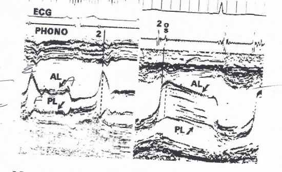 Question 15