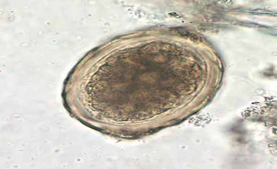 Parasitology Microscopic Images Review - Flashcards