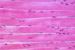 Skeletal Muscle:
Identify And Give Examples ... - Flashcard