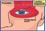 Orbicularis Oculi - Flashcard