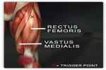RECTUS FEMORIS

(over Femur)
 - Flashcard