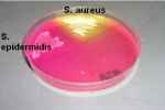 
	Mannitol Salt Agar (MSA) 
 - Flashcard