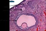 Identify This Tissue Type, Then Identify The ... - Flashcard