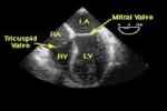 CARDIAC DIAGNOSTICS
Echocardiography - Flashcard