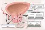 Lower Urinary Tract - Flashcard