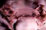 EPIGLOTTIS - Flashcard