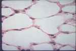  - Flashcard