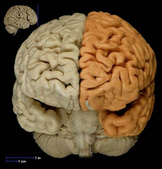 Cerebral Hemispheres - Flashcard