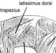 Latissimus Dorsi  - Flashcard