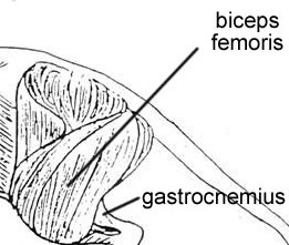 Bicep Femoris - Flashcard