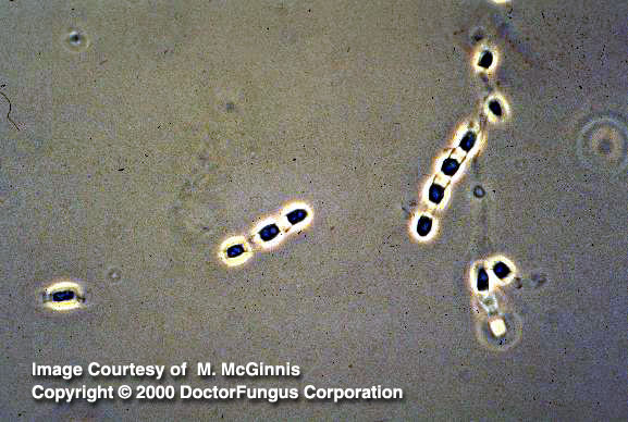 Tissue Or Mold Form - Flashcard