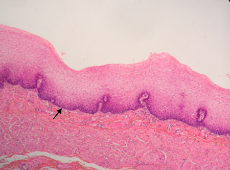 Stratified Squamous Epithelial Tissue - Flashcard