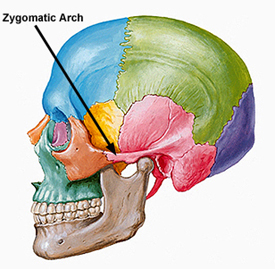 Zygomatic Bone - Flashcard