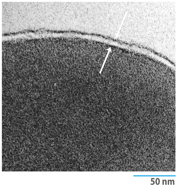 In Transmission Electron
Microscopy (TEM), H... - Flashcard