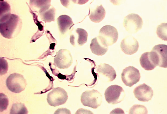 Clade Discicristales: Trypanosome - Flashcard