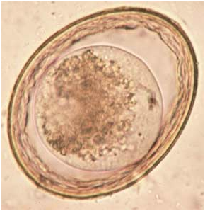 Toxascaris Leonina - Flashcard