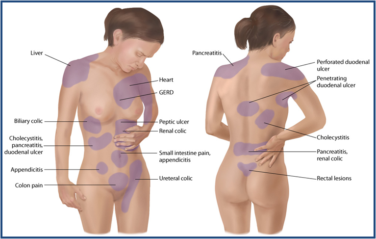 What Is Referred Pain? Give An Example - Flashcard