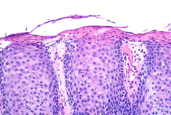 Provides Oxygen And Nutrition To The Epidermi... - Flashcard