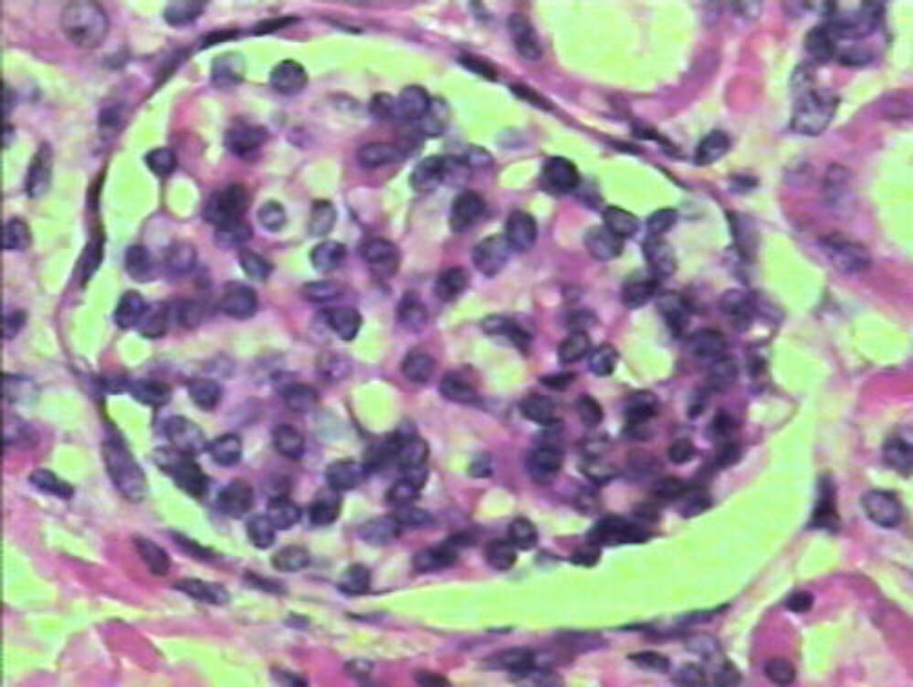 Simple Squamous Epithelium - Flashcard