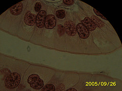 Simple Columnar Epithelium - Flashcard