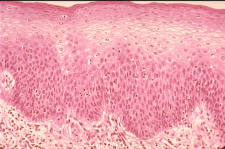 Stratified Squamous Epithelium - Flashcard