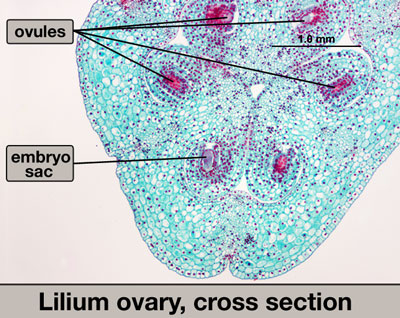 Identify These Microscope Slide of These Organism Flashcards - Flashcards