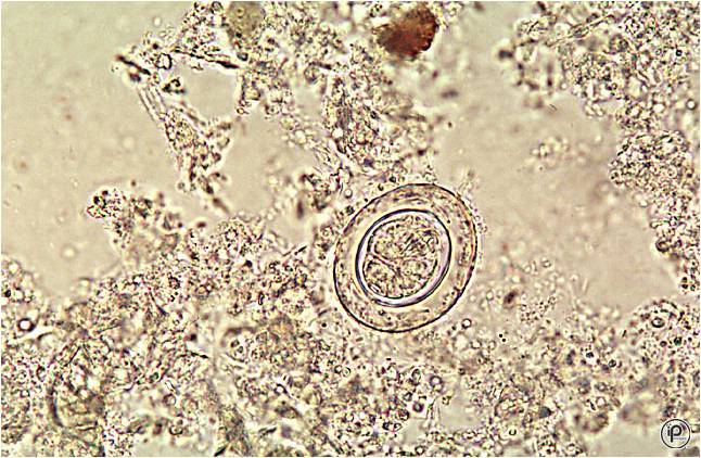 Cestodes Nematodes and Trematodes Flashcards - Flashcards