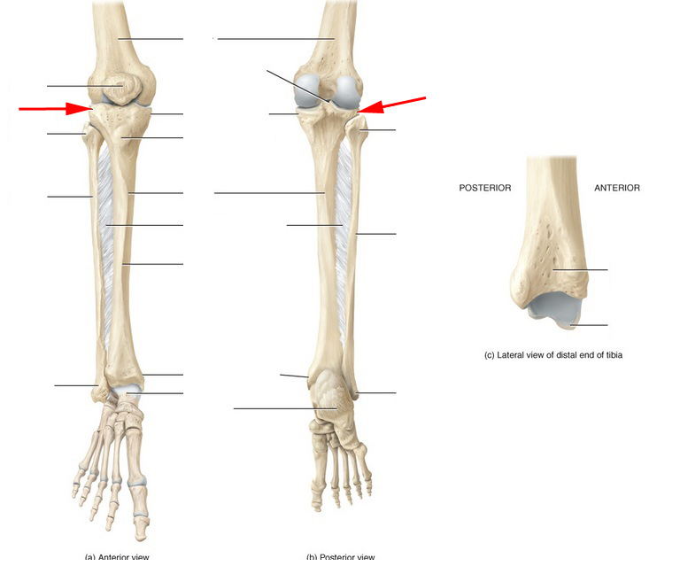 What Part Of The Tibia Is This? - Flashcard