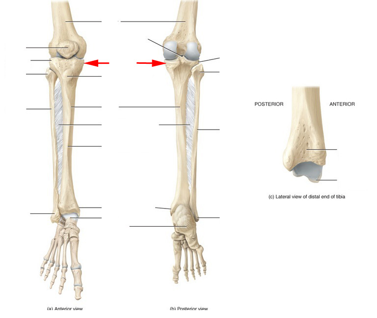 What Part Of The Tibia Is This? - Flashcard