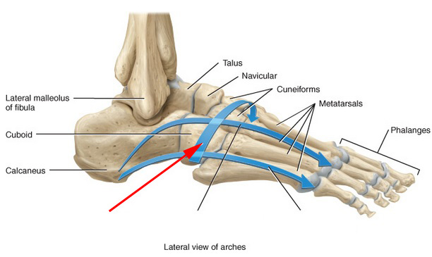 Which Foot Arch Is This?
 - Flashcard