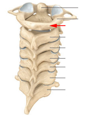 Skeletal Anatomy of Vertebral Column Part II - Flashcards