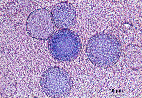 Tissue Or Mold Form? - Flashcard