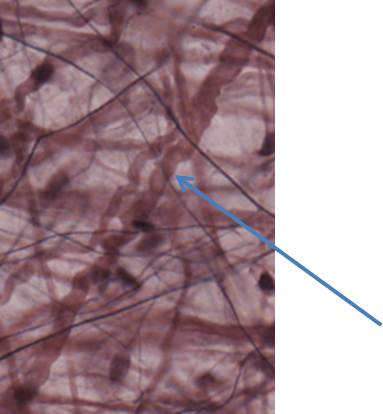 What Type Of Fiber Is This? - Flashcard