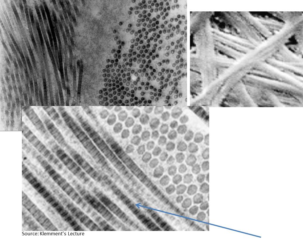 What Types Of Fibers Are These? - Flashcard