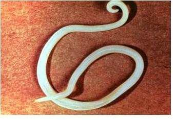 Advanced Medical Quiz: Shock And Parasitology - Quiz
