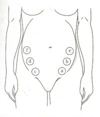 NCLEX Positions - Flashcards