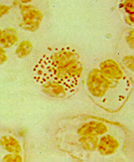 Microbiology Of Neisseria And Moraxella - Flashcard