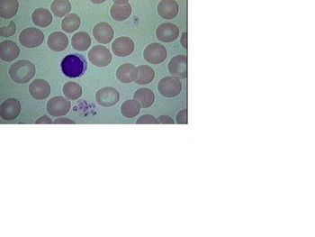 What Type Of Cells Are Shown Below? - Flashcard