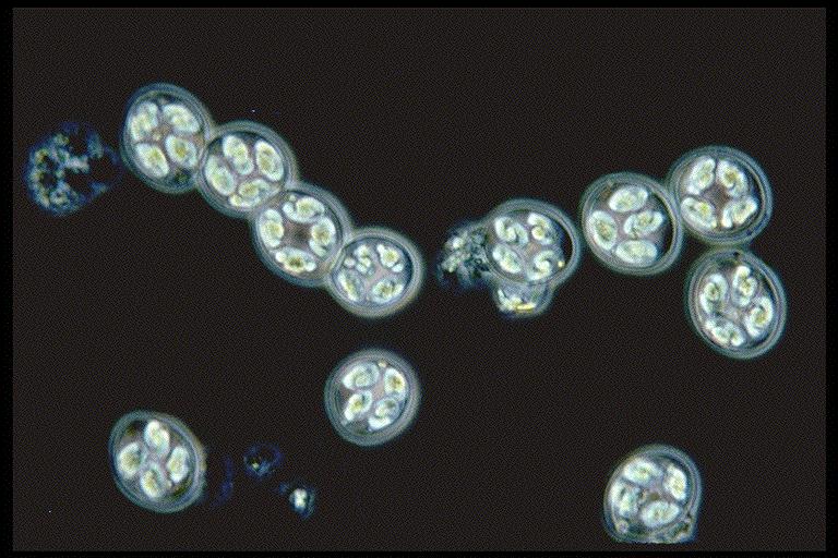 What Parasite Is This?
Not Species Specific - Flashcard