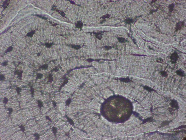 Name This Tissue & (3) Structures - Flashcard