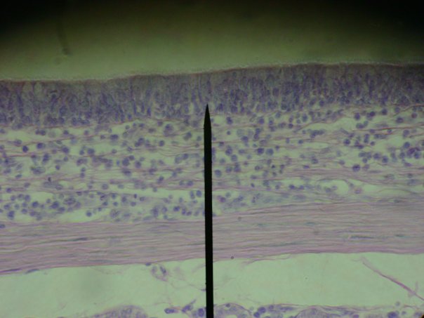 Consists Of Cells Of Different Heights That R... - Flashcard