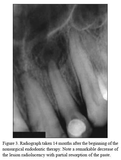 What Radiolucent Lesion Is This? - Flashcard