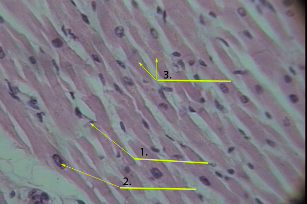 Identify These Cardiac Muscle Tissue Slides Flashcards - Flashcards