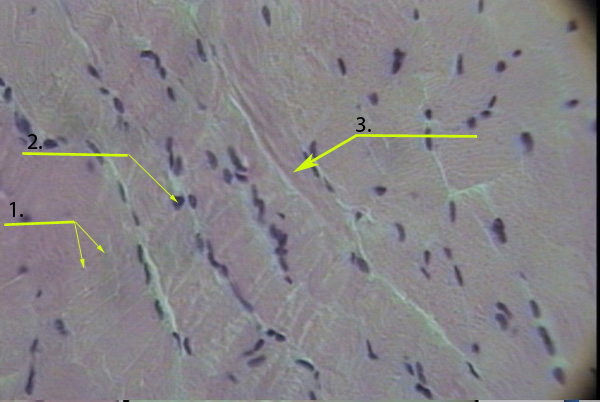 What Type Of Tissue Is This?  Label The Numbe... - Flashcard