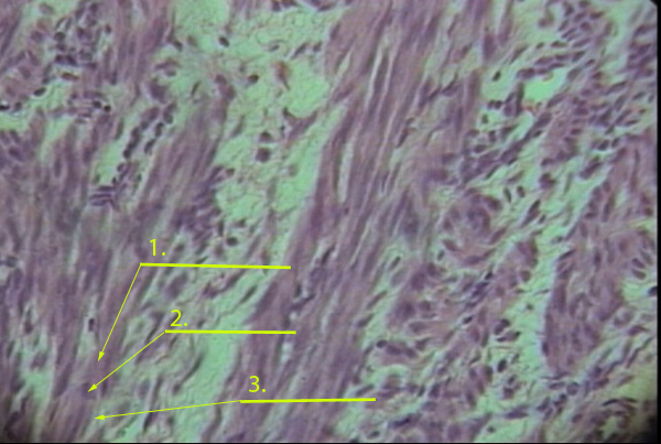 What Type Of Tissue Is This?  Label The Numbe... - Flashcard