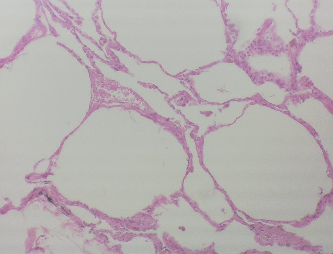 Simple Squamous Epithelium - Flashcard