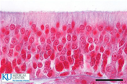 Pseudostratified Columnar Epithelium - Flashcard