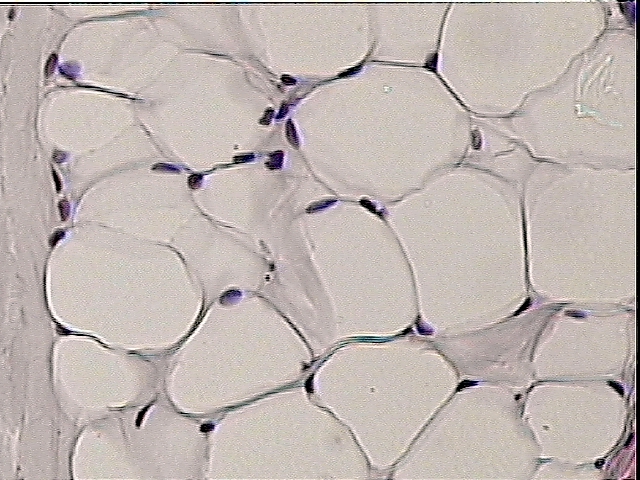 Adipose Connective Epithelium - Flashcards